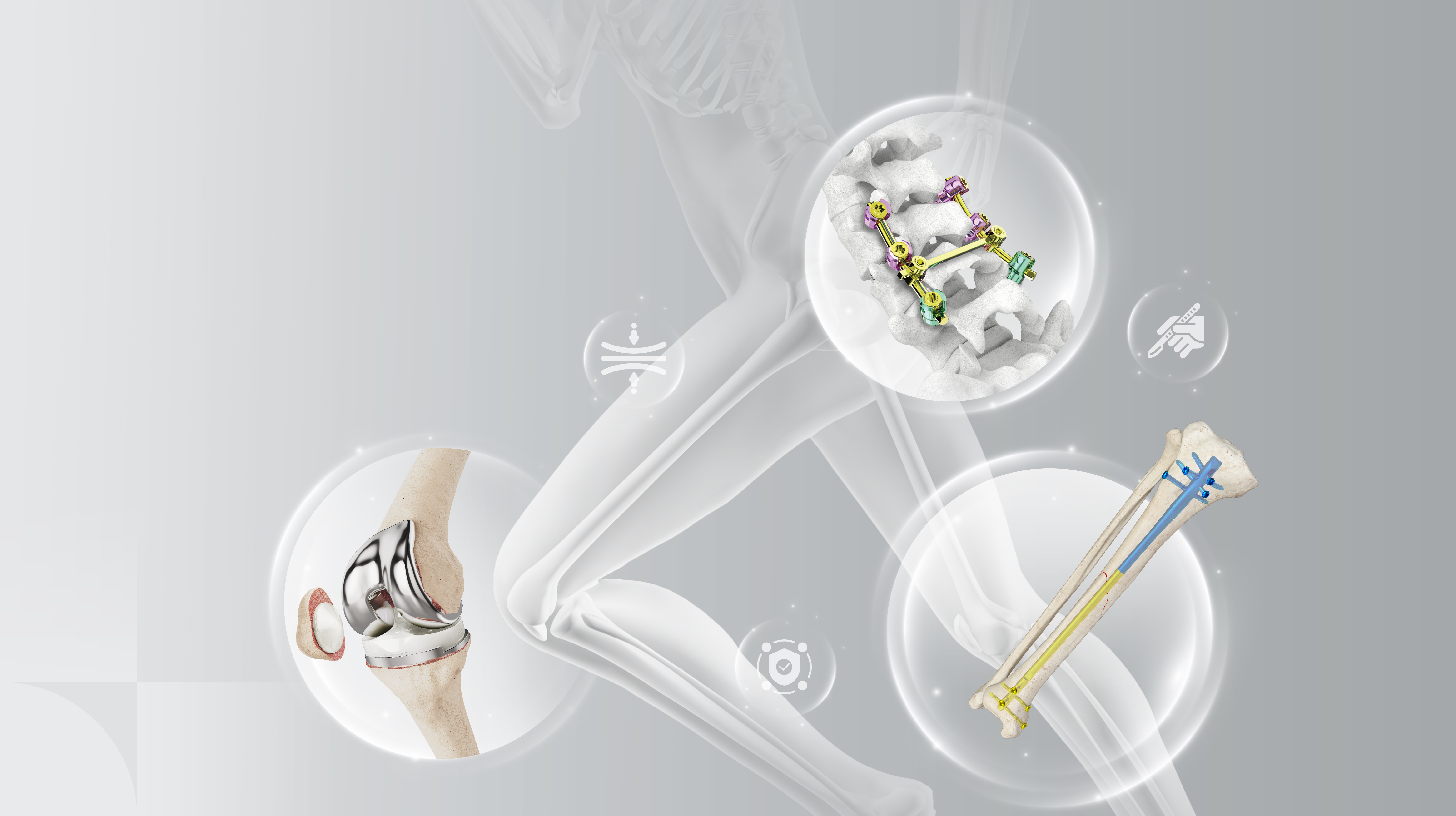 Mindray Orthopaedics Solution Key Visual