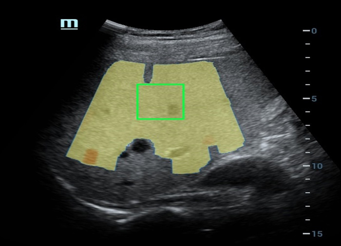 pg电子游戏(试玩)官方网站-APP下载