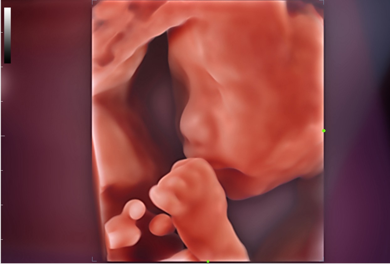 pg电子游戏(试玩)官方网站-APP下载