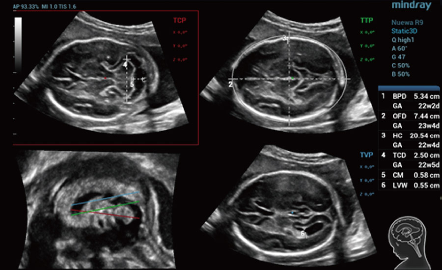 pg电子游戏(试玩)官方网站-APP下载