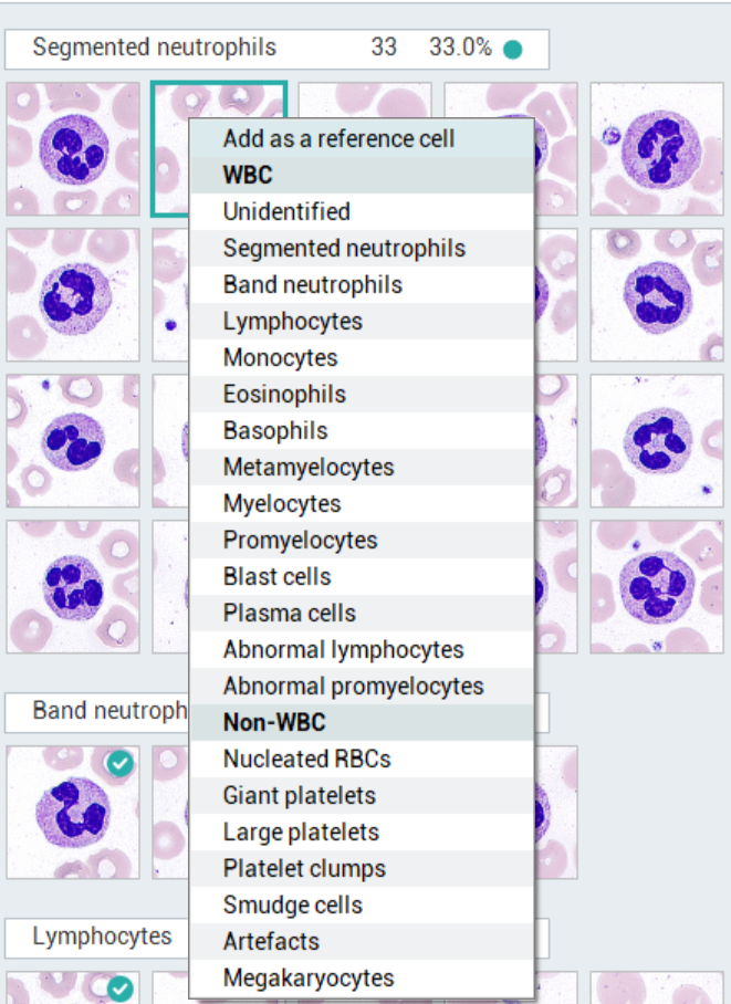 MC-80 WBC images to reference cells