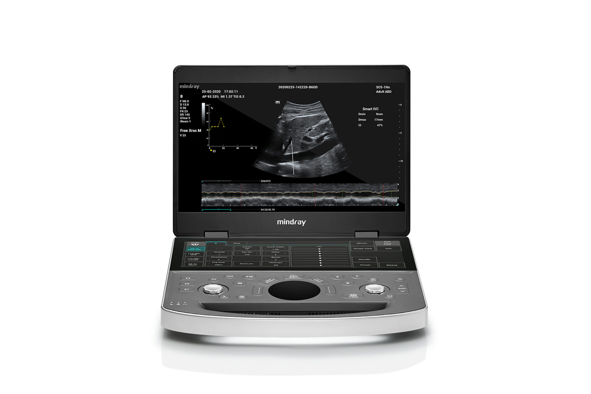 ME8-ABD-Scan-2000x0-c-default