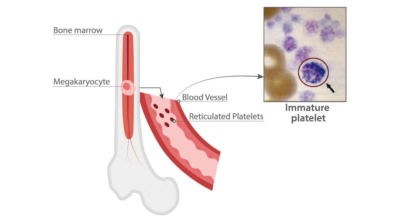 immature-platelet