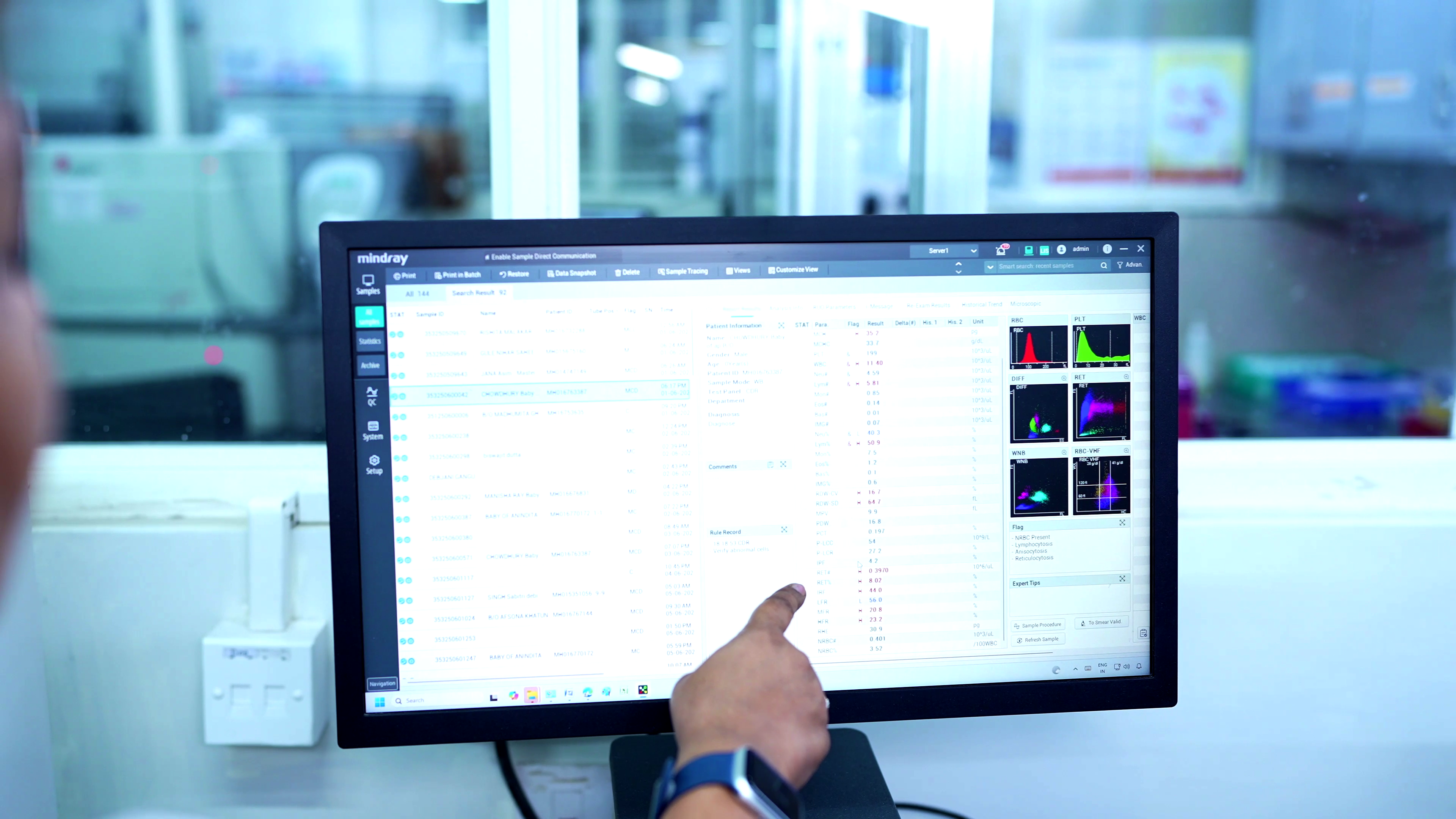Advanced parameters visual (left)