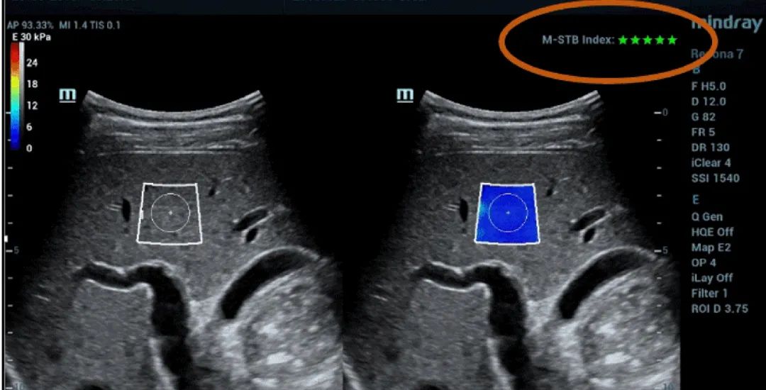 97575f02-5fb0-4c59-a0d3-16eaff278a54_5