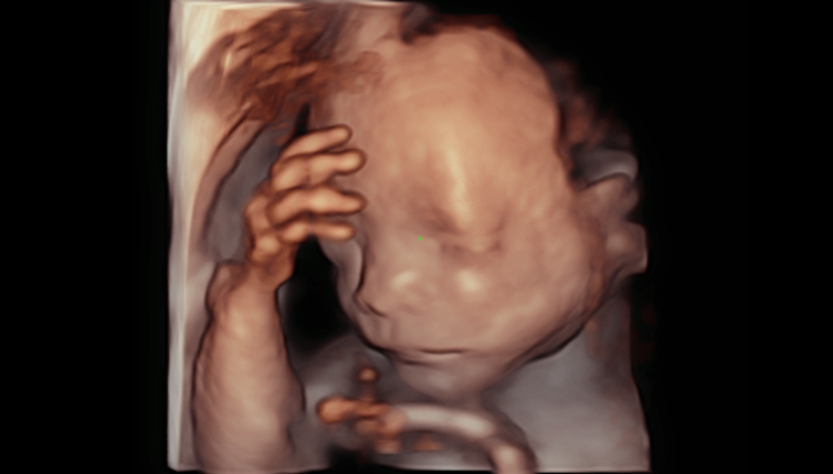 dc-80-exp-ru-fig3-3-pc