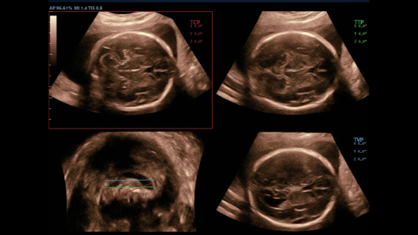 dc-80-exp-ru-fig4-1-pc