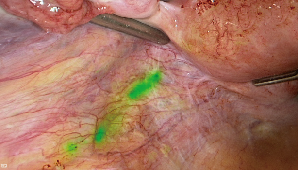 pg电子游戏(试玩)官方网站-APP下载