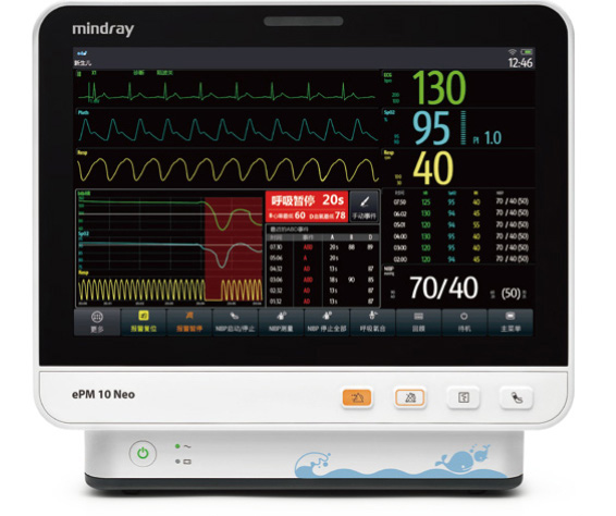 epm-10-neo-fig1-pc-1