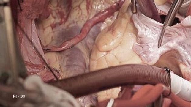 hyled-q-series-true-colors-ra-80-1.0-cn