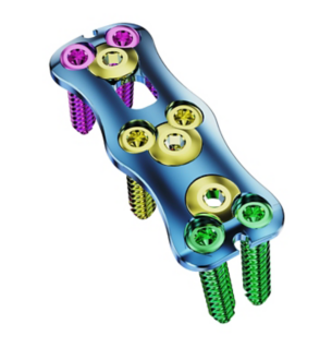 MS Anterior Cervical Plate System