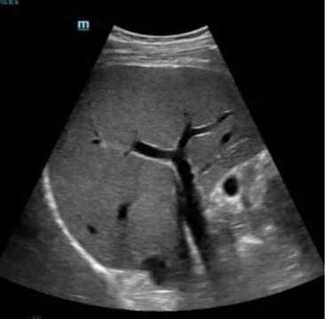 Mindray to Showcase Leading-Edge Ultrasound Solutions at 2021 Vascular Annual Meeting