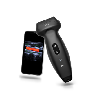 TE Air e5M Wireless Handheld Ultrasound System