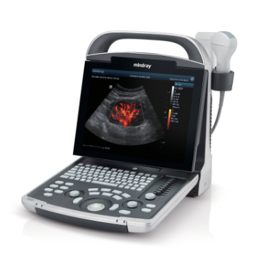 DP-30 Power Ultrasound Imaging System: