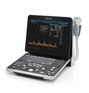DP-50 Expert Mobile Ultrasound System: