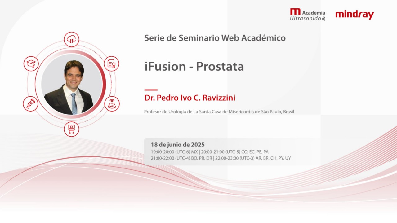iFusion - Prostata