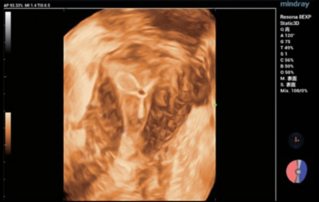 Ultrasound Journal 4 - ?? ? ?? ??? ??
