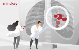 Warto?? diagnostyczna ProGRP oraz NSE w przypadku drobnokomórkowego raka p?uc