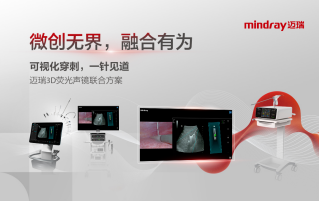 “手术路径导航”辅助操作统一价钱立项，，pg电子融合立异助“精准医疗”转型提速